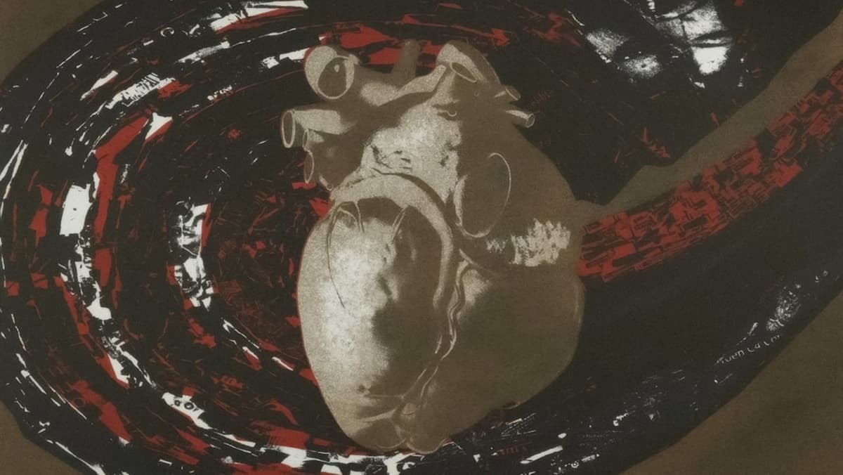 ลาก่อนยาละลายลิ่มเลือด? นักวิจัยผุดไอเดียฉีด 'เจลแม่เหล็ก' อุดรูรั่วหัวใจกันสโตรก