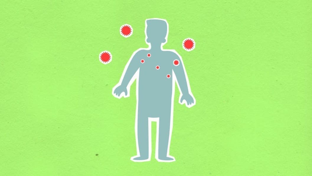 ไขปริศนา Long COVID! นักวิทย์ชี้ 'ภูมิคุ้มกันทำลายตัวเอง' คือต้นเหตุอาการเรื้อรัง