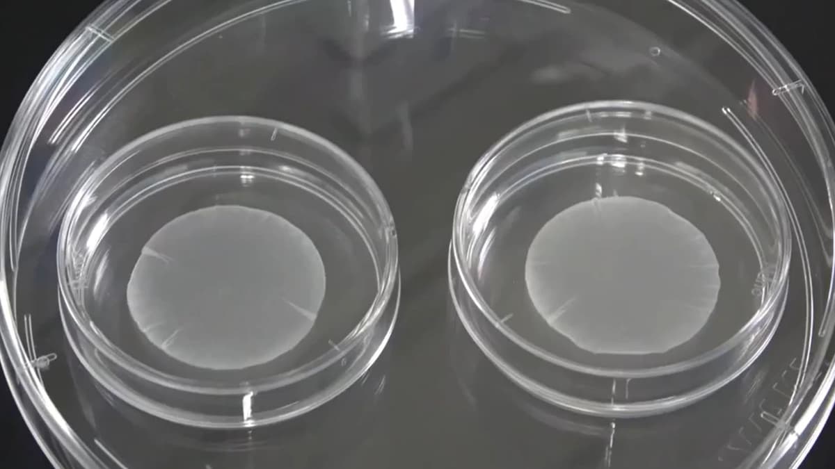 ครั้งแรกของโลก! ญี่ปุ่นไฟเขียวสเต็มเซลล์ iPS รักษาพาร์กินสัน-หัวใจล้มเหลว