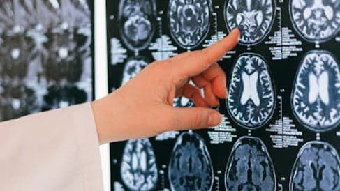 ลืมเรื่องเล่นครอสเวิร์ดไปเลย! วิจัยชี้ “การท้าทายสมอง” คือกุญแจกันสมองเสื่อม